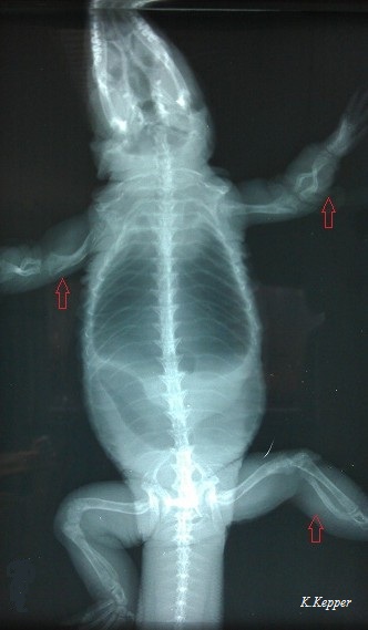 Rachitis Röntgenbild